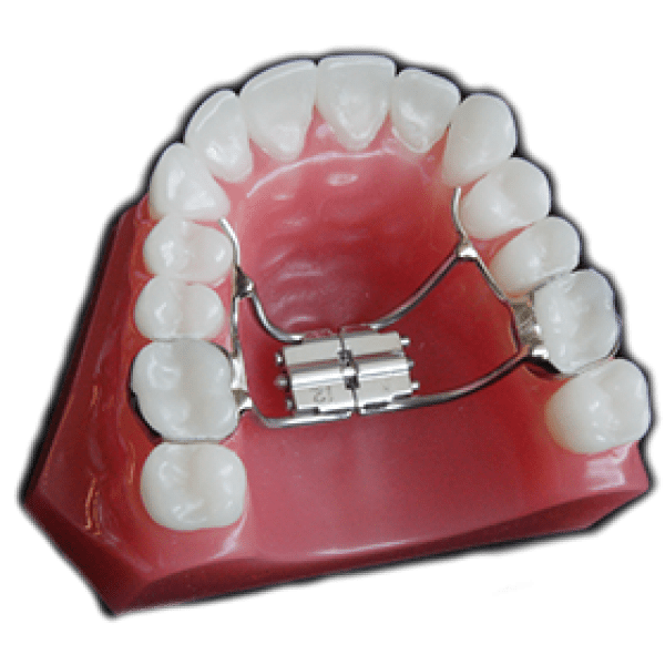 Rapid Palatal Expanders (28199)